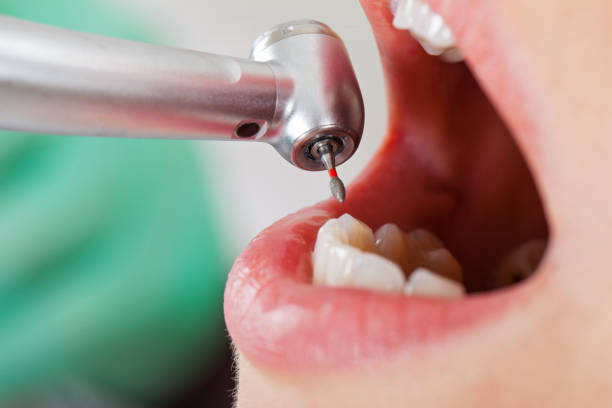 Best Dental Abscess Treatment in Hurricane, WV